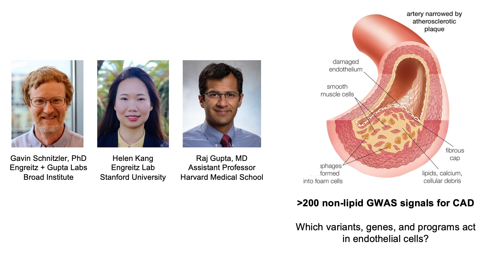 The V2G2P workflow applied to endothelial cells and coronary artery disease, from GWAS signal through enhancer–gene link to perturbation-derived gene program.